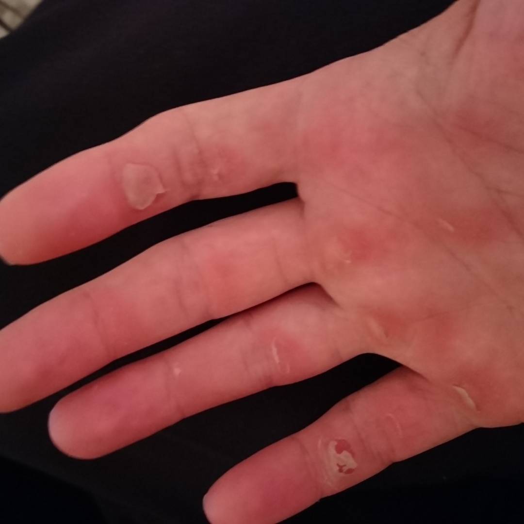 Climbing aftermath