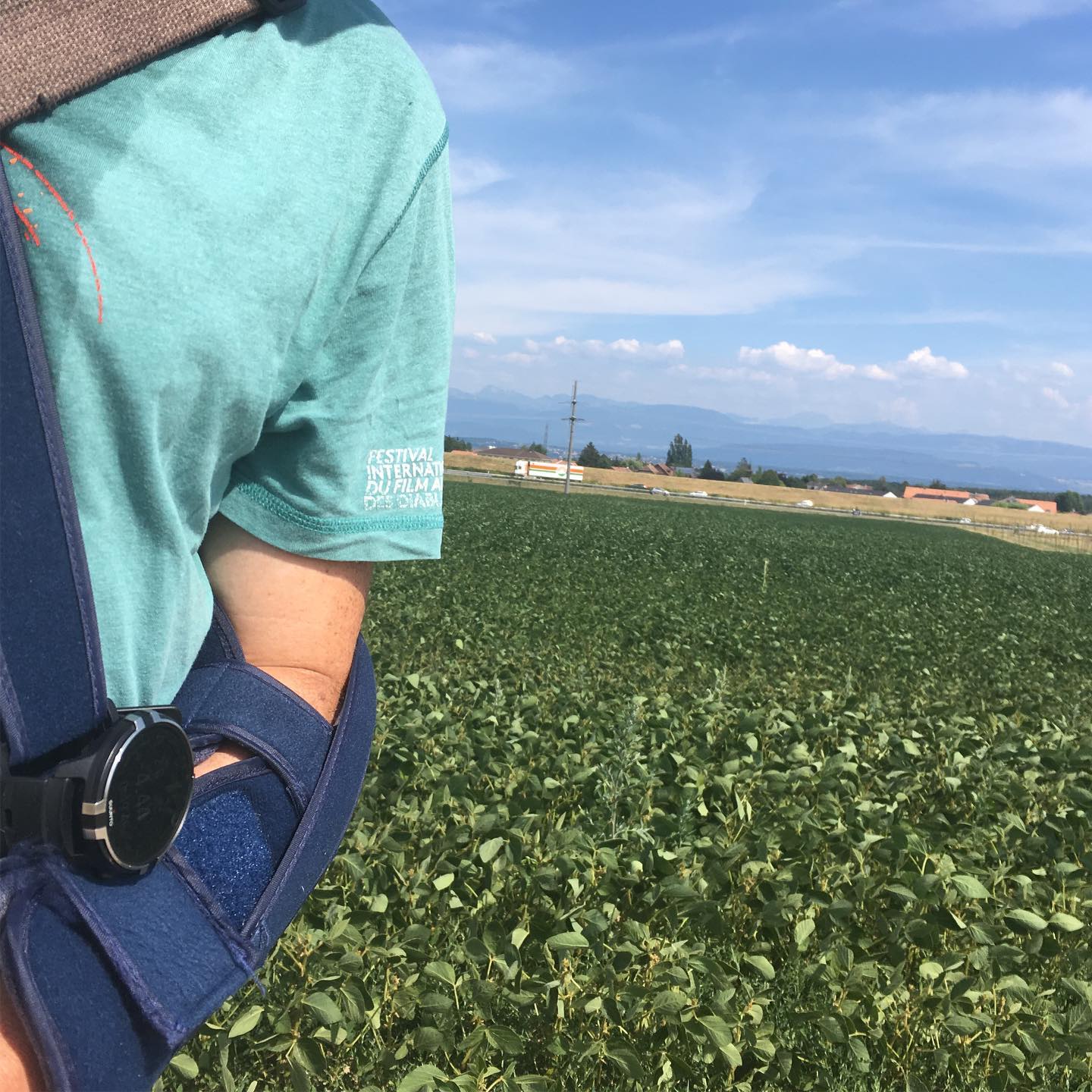 This is an #injurie ;-). A picture with an injury ;-)